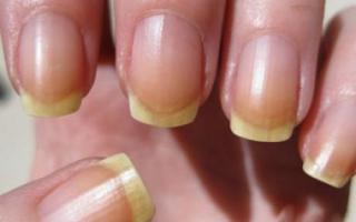 Как без труда отбелить ногти в домашних условиях, чтобы они приобрели естественный цвет?